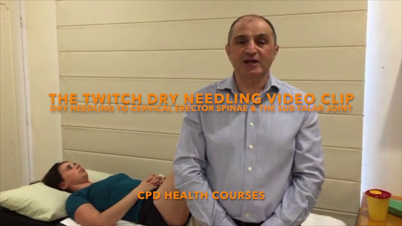 DRY NEEDLING TO CERVICAL ERECTOR SPINAE & THE SUB TALAR JOINT