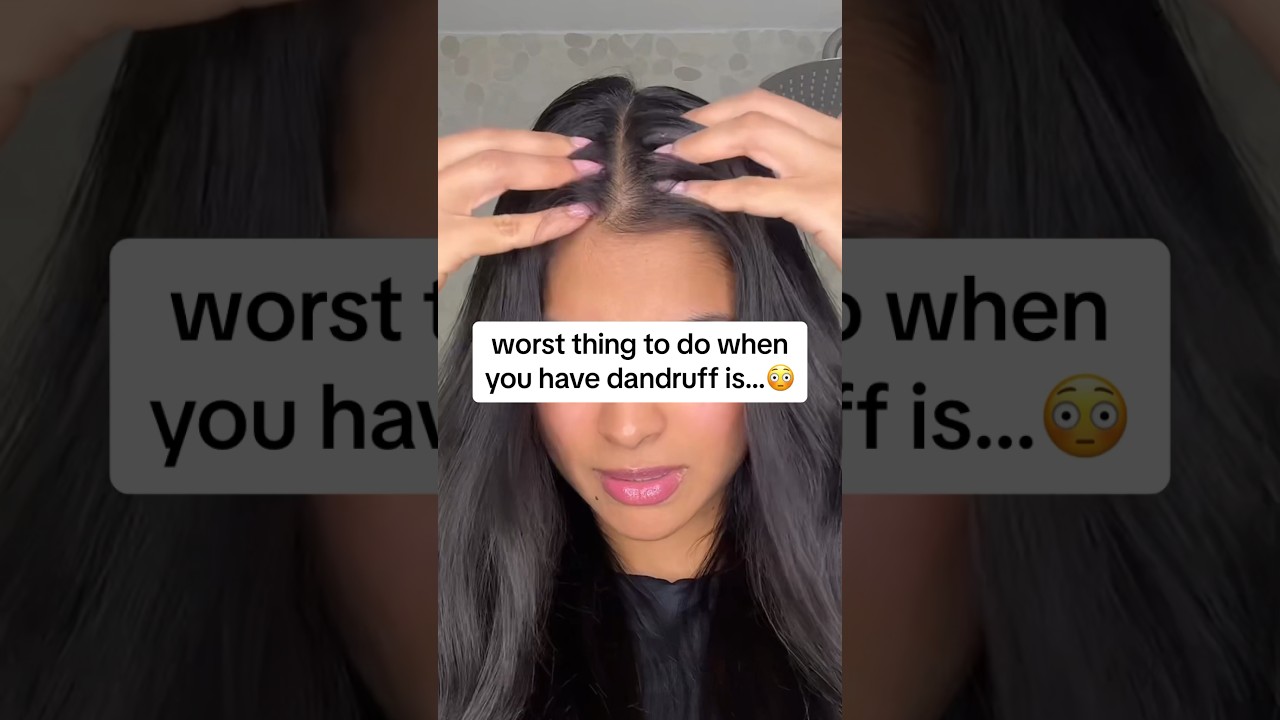 this triggers more dandruff than anything! 🥲 | hair growth tips #youtubeshort #hair #hairgrowth
