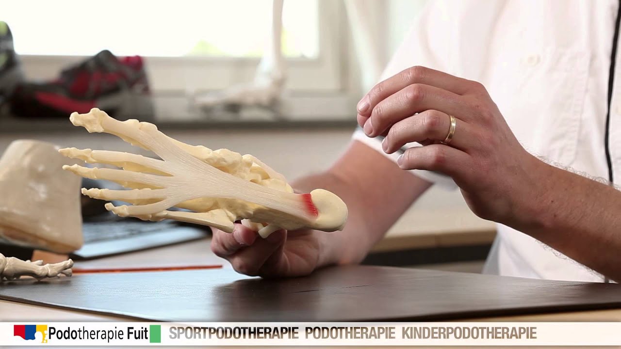 Peesplaatontsteking / hielspoor (Fasciïtis Plantaris) 4/10