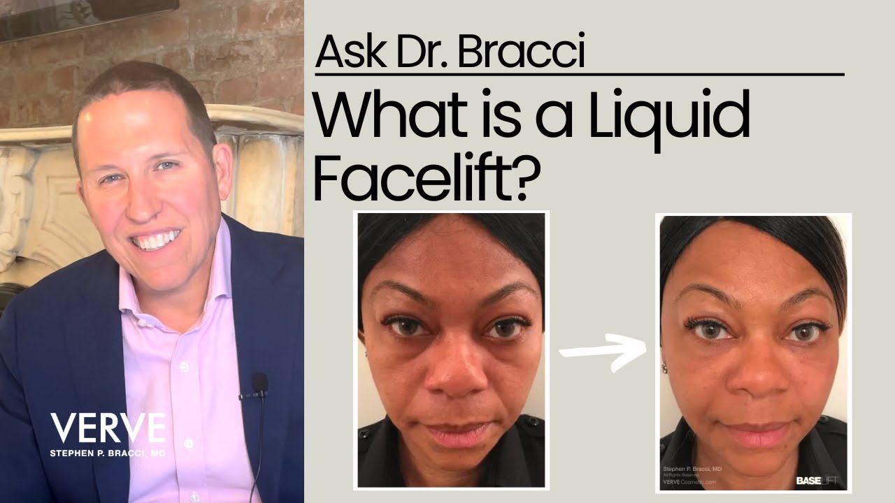 What is a Liquid Facelift? | Ask Dr. Bracci