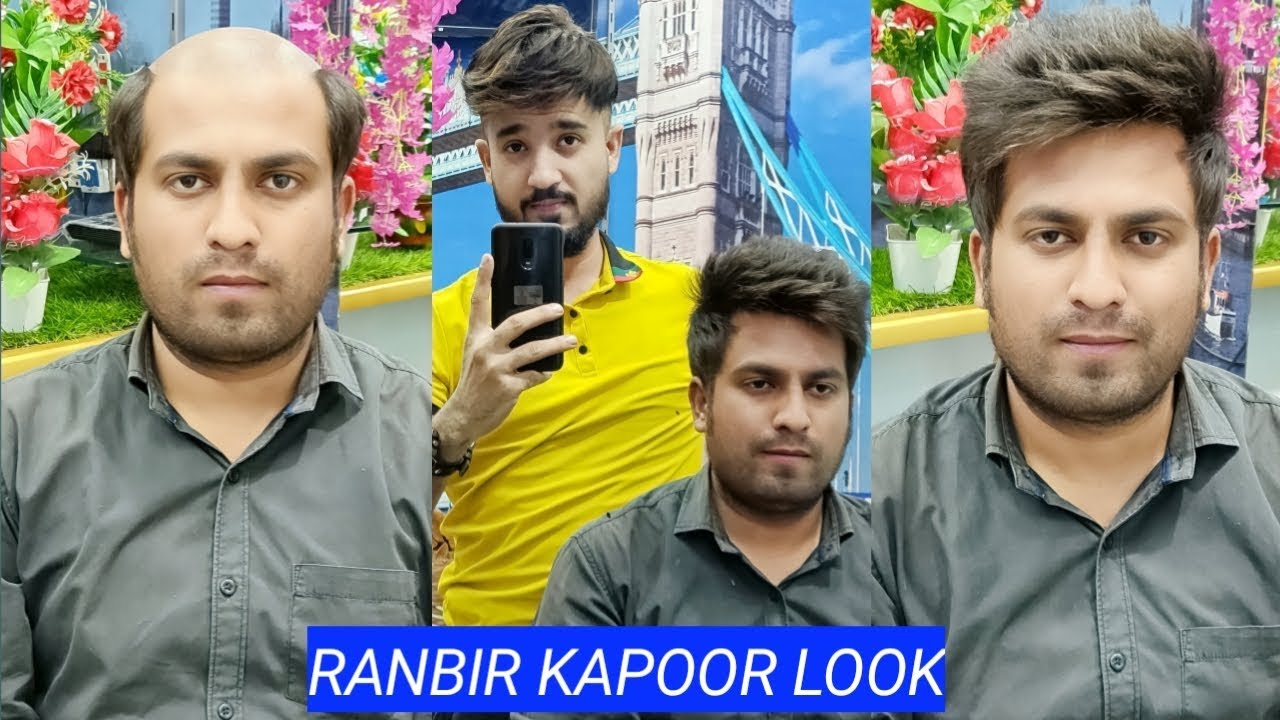 A nonsurgical hair transformation in DELHI by anas sheikh, call us 📲 9650914665 whatsap also
