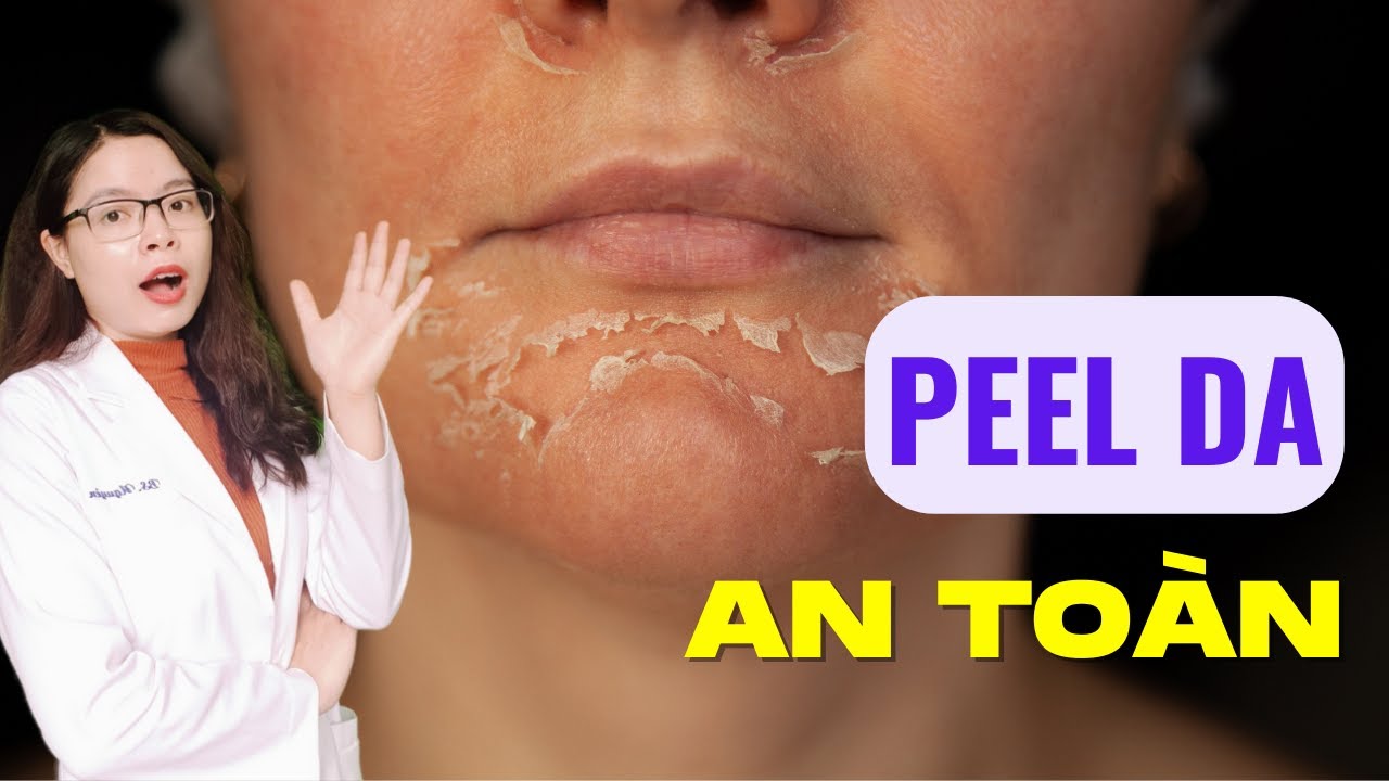 5 Lưu ý quan trọng khi peel da để da bóng mịn bất ngờ - Bác sĩ Nguyên