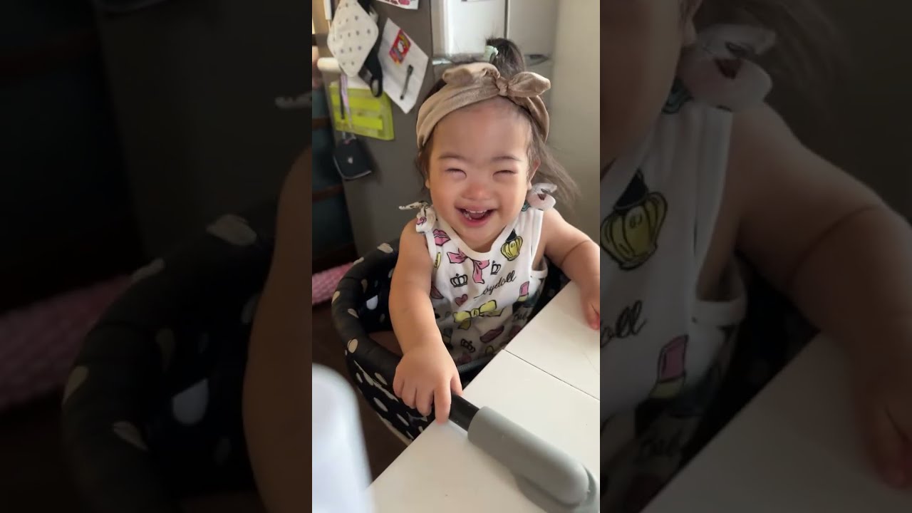 The baby has Down syndrome 312