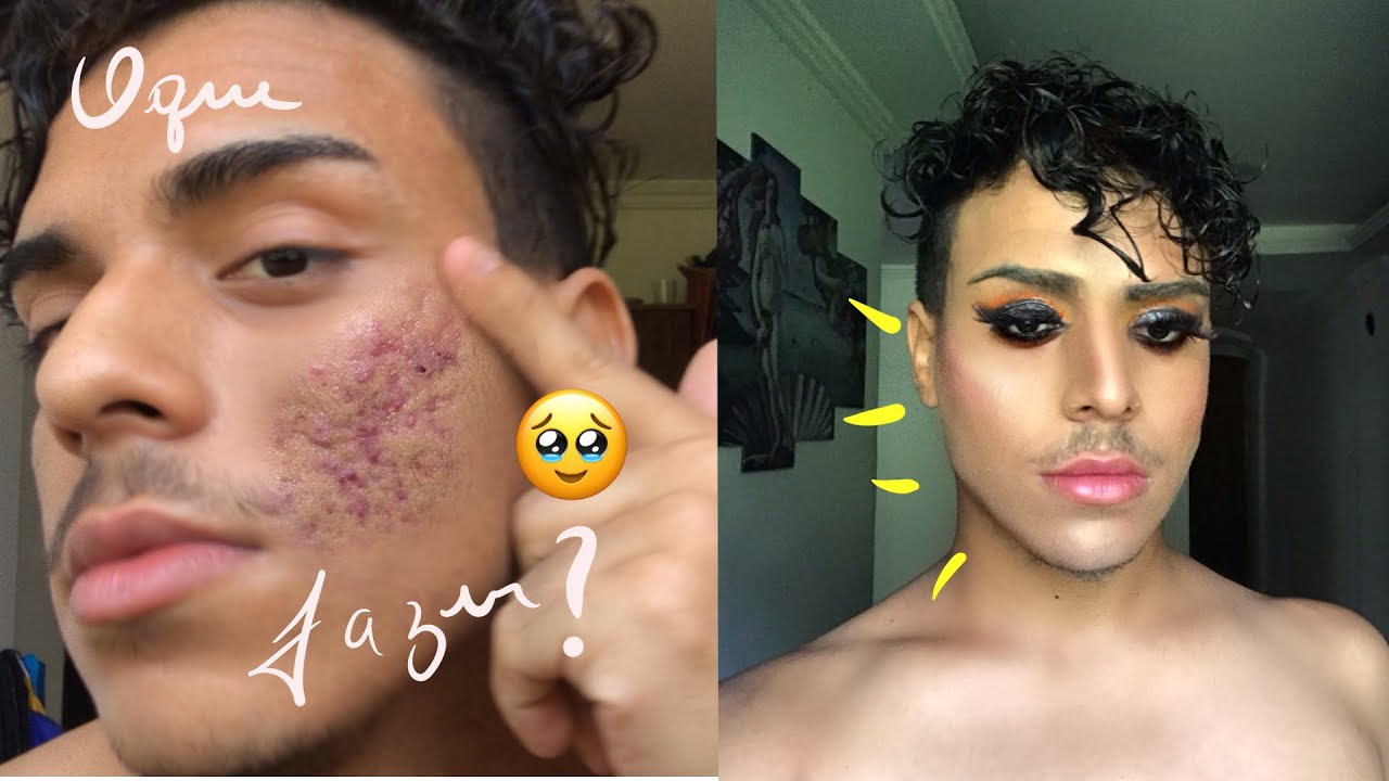 Como ESCONDER POROS E CICATRIZ de acne com maquiagem ?