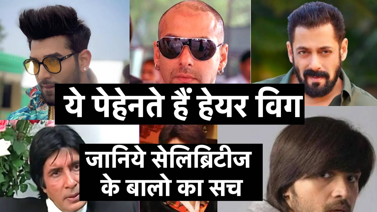 Celebrities jo hair patch/wig lagate hain | Salman | Himesh | Kapil | Amitabh | Paras Chhabra