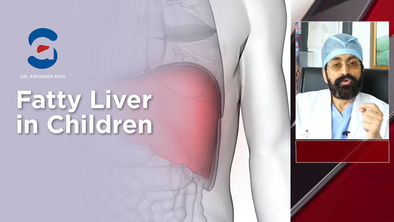 Fatty Liver | Symptoms | Treatment | Cirrhosis | 2nd grade | Lakshan | Talk with Dr. Arvinder Soin