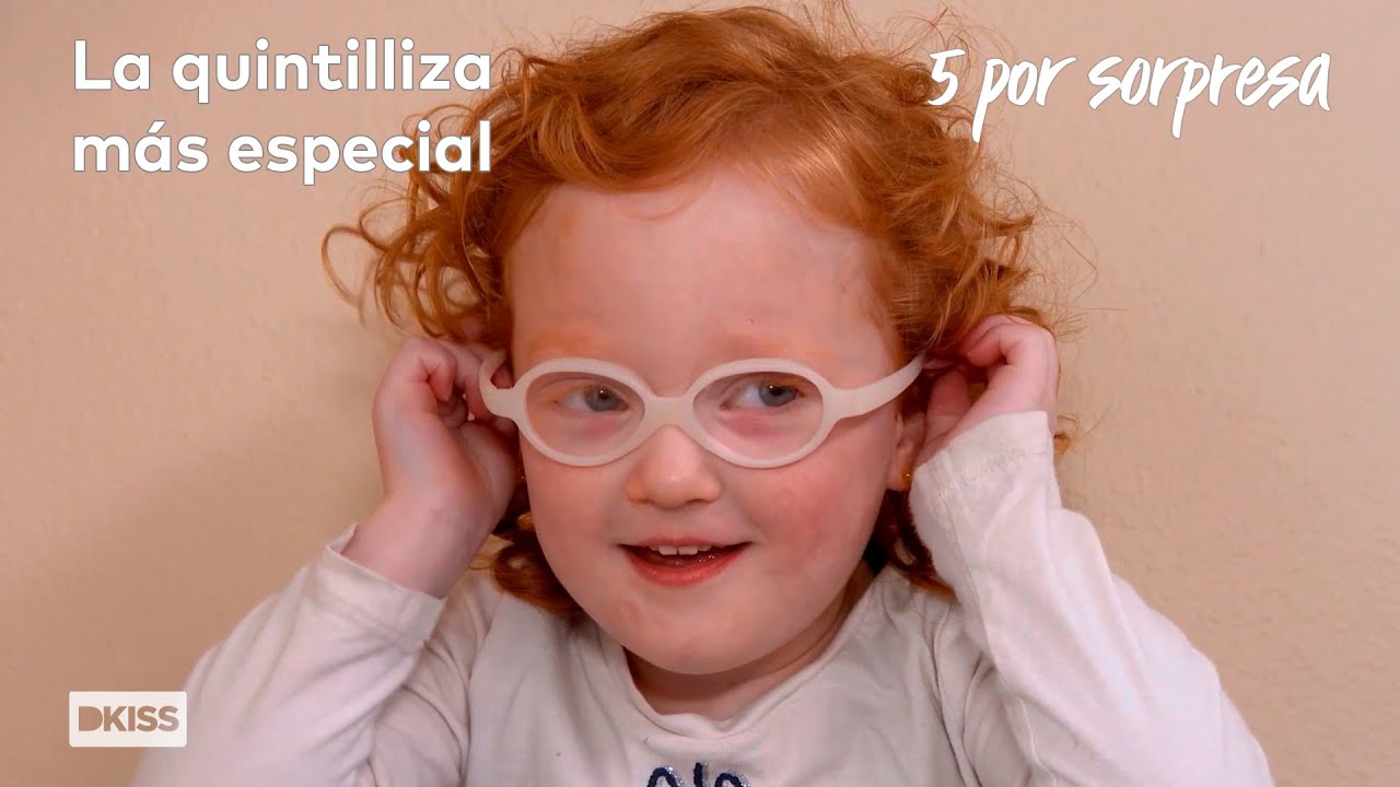 Todo sobre Hazel Busby: de su cirugía ocular a su primer amor | Cinco por sorpresa