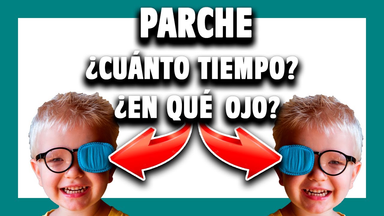 🟩 OJO VAGO: ¿en qué OJO poner el PARCHE? ¿Horas al día? [Cap. #8]