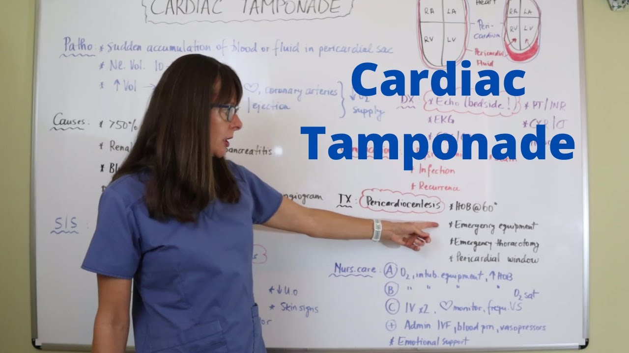 Cardiac Tamponade