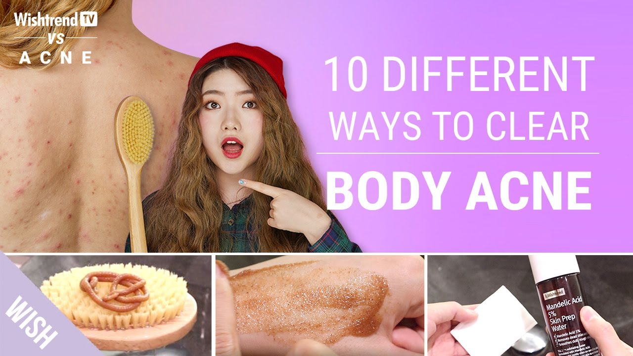 Bad Shower Habits Causing Body Acne l Clear Body Skin Care Tips