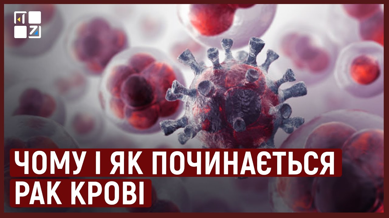 Чому і як починається рак крові. Симптоми та лікування | Ольга Дорош, Роман Куць
