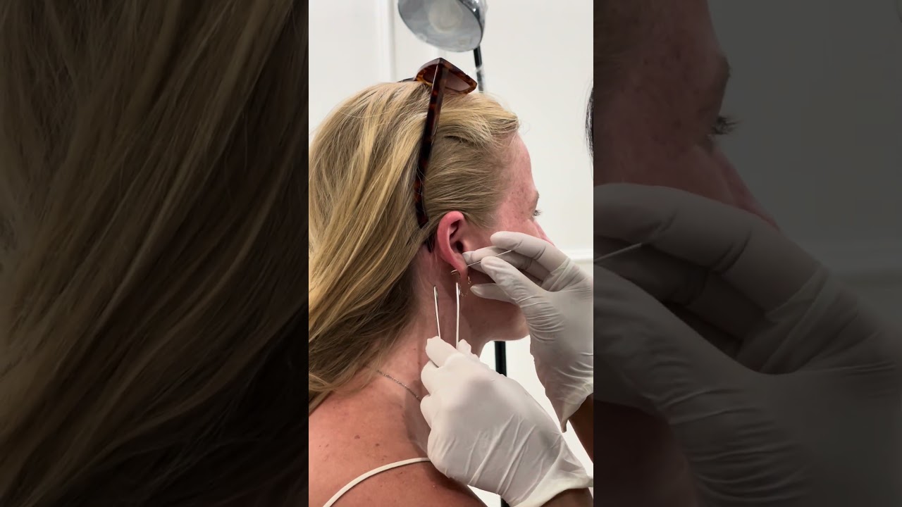 Double Upper Lobe Piercing - BALI