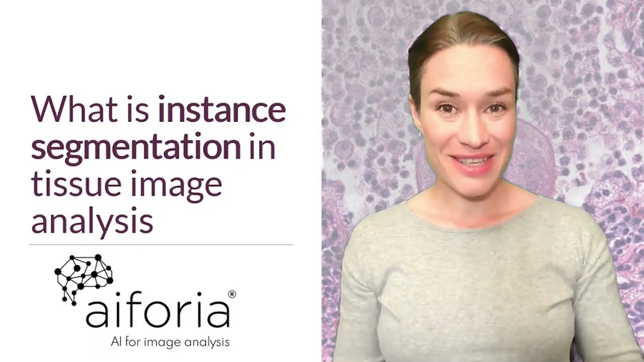 Instance segmentation for digital pathology tissue image analysis explained on Aiforia platform