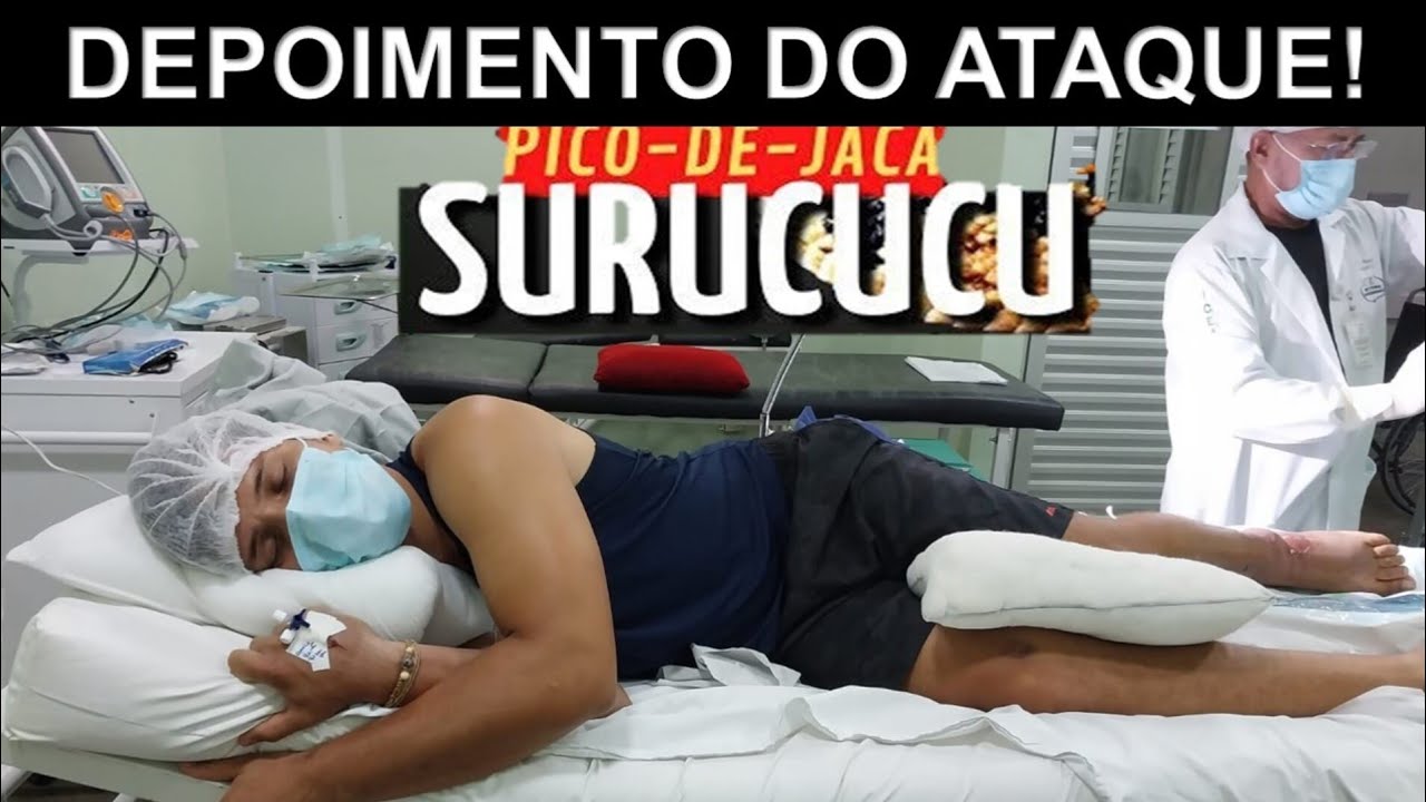 TIVE MEDO DE MORRER E ACHEI QUE ERA O FIM (Depoimento do ataque da Surucucu-pico de jaca)