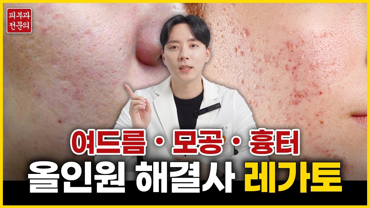 레가토｜여드름, 모공, 흉터 치료를 한 번에 해결하기!