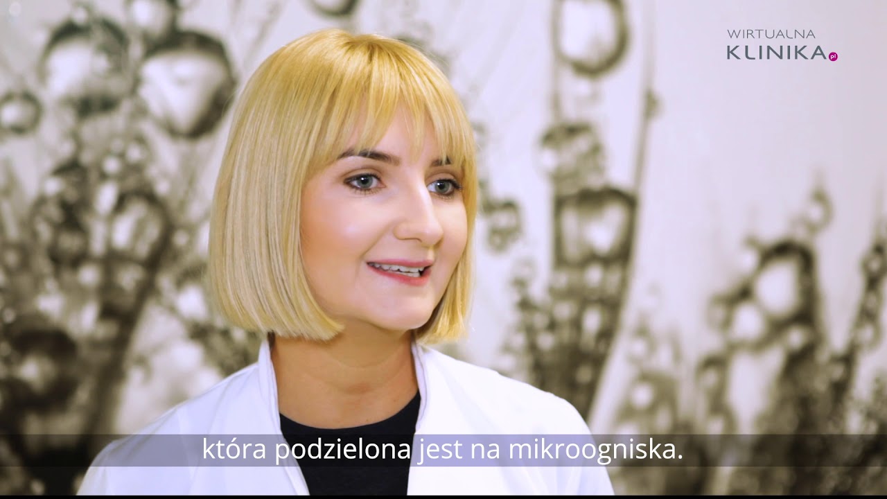 Laser pikosekundowy na przebarwienia i naczynka