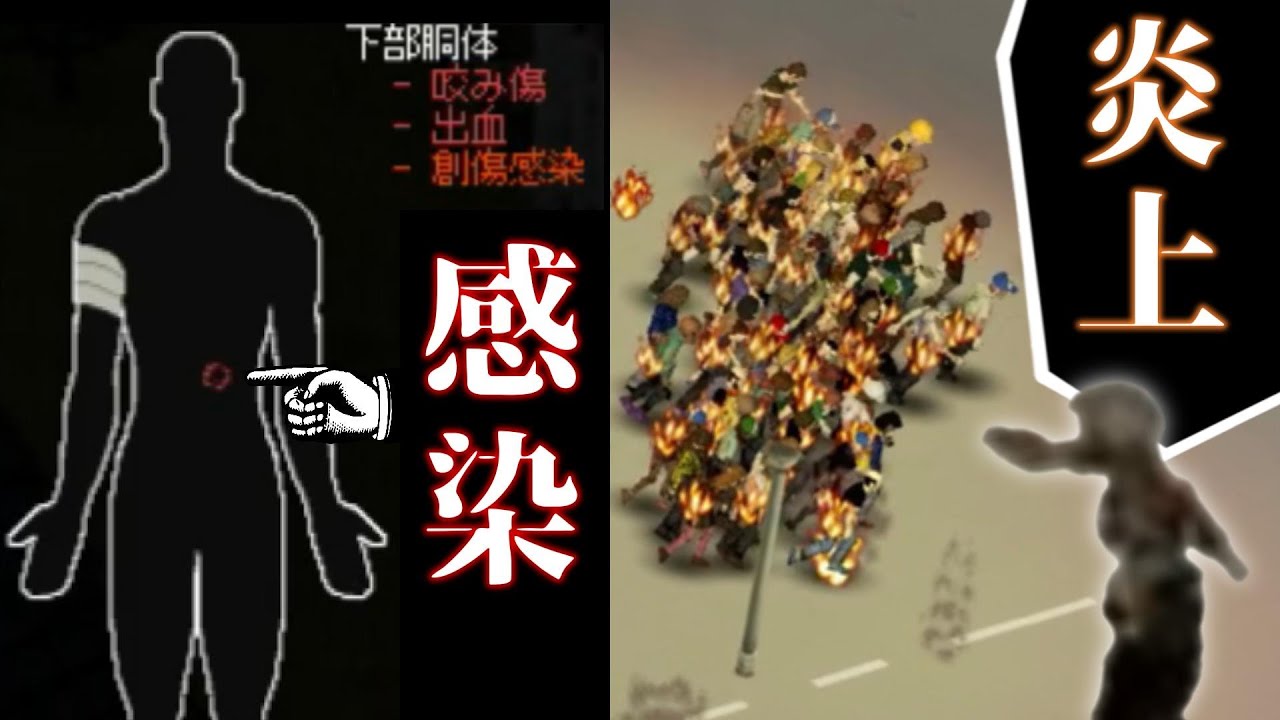 嚙まれた傷から感染してしまい最後までやりたい放題をして天寿を全うしたZomboid｜Project Zomboid