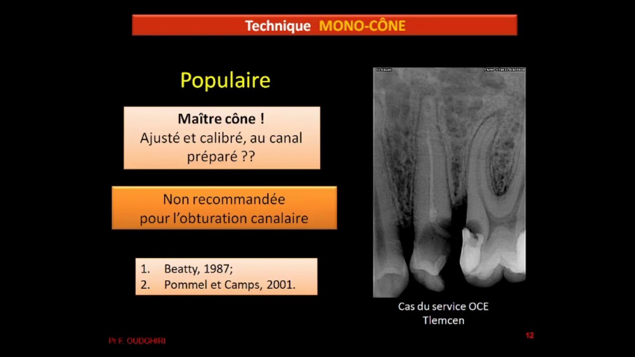 5  Les principales techniques d'obturation canalaire