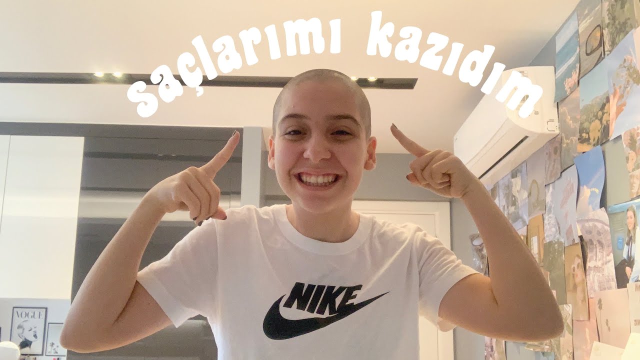 SAÇLARIMI KAZIDIM 😱