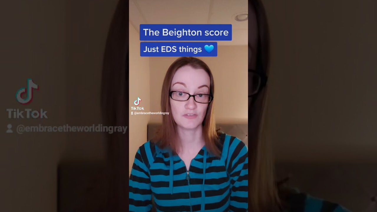 The Beighton score has its limitations