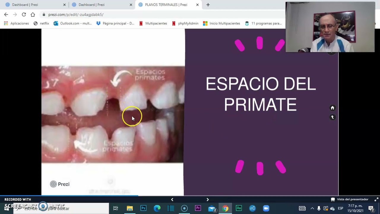 Planos terminales. Espacios del primate. Taller N°1. ANÁLISIS DENTAL.CCHAPARRO.