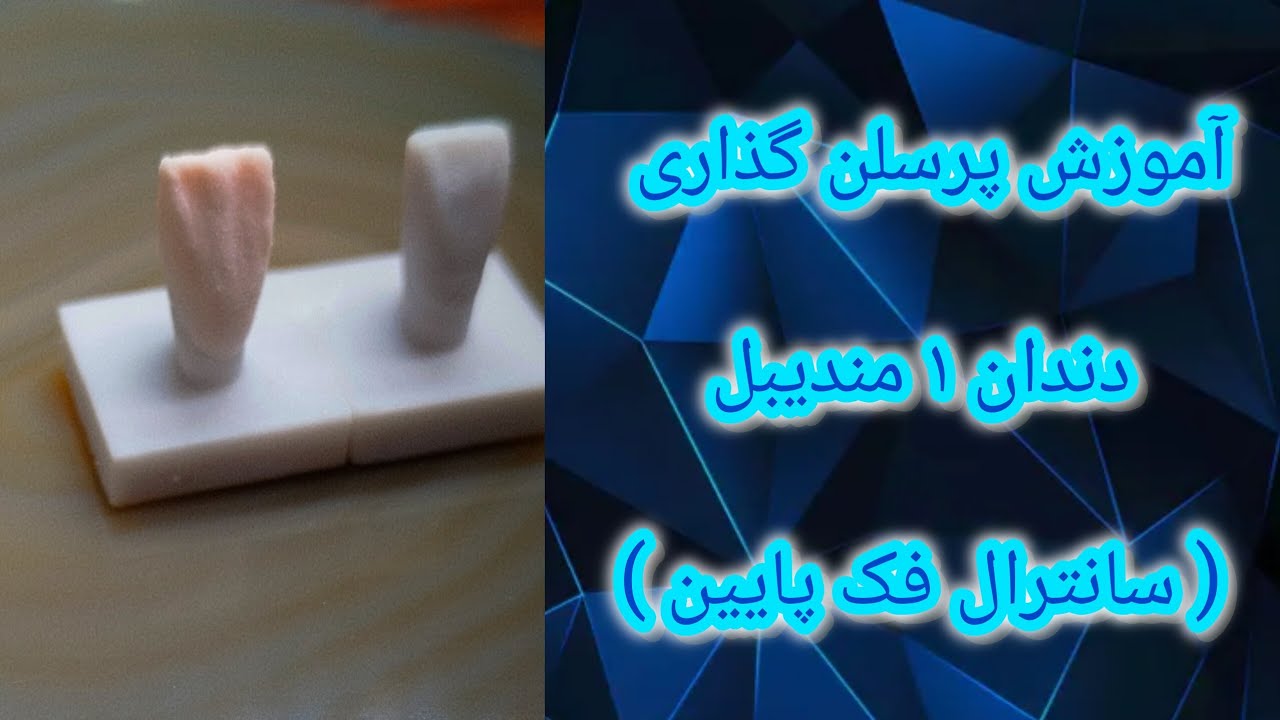 🔥آموزش پرسلن گذاری دندان 1مندیبل (سانترال فک پایین) | مرحله به مرحله با جزئیات کامل 🎯🦷🎨🖌️👩🏼‍🔬👩🏼‍⚕️