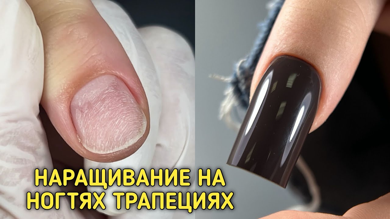 Верхние формы | наращивание на ногтях-трапециях | дизайн ногтей для подростка💅