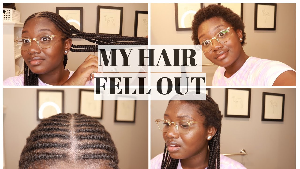 FULANI BRAIDS TAKEDOWN - HAIR LOSS, ALLERGIC REACTION?!
