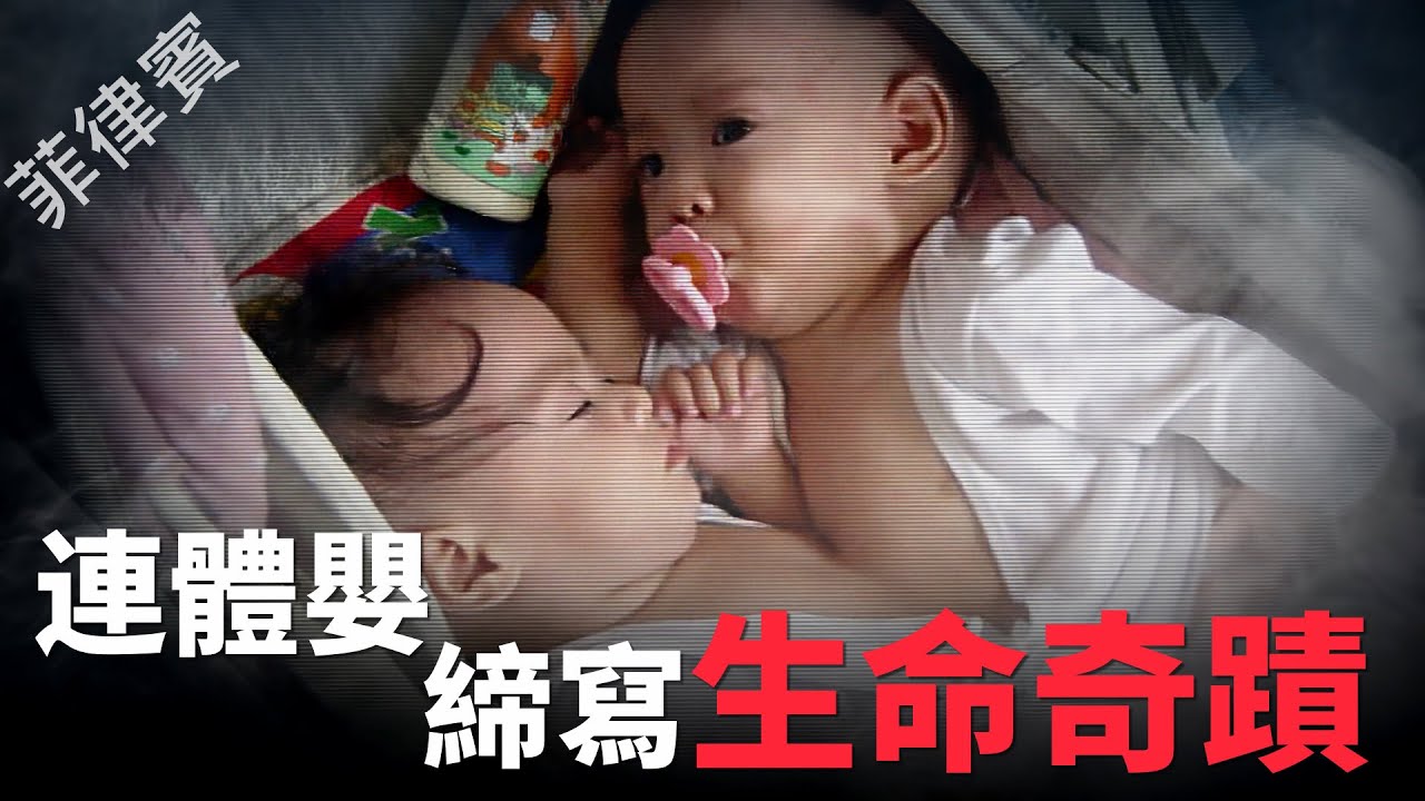 【風月同天｜人物故事】 菲律賓連體嬰締寫生命奇蹟 20260126