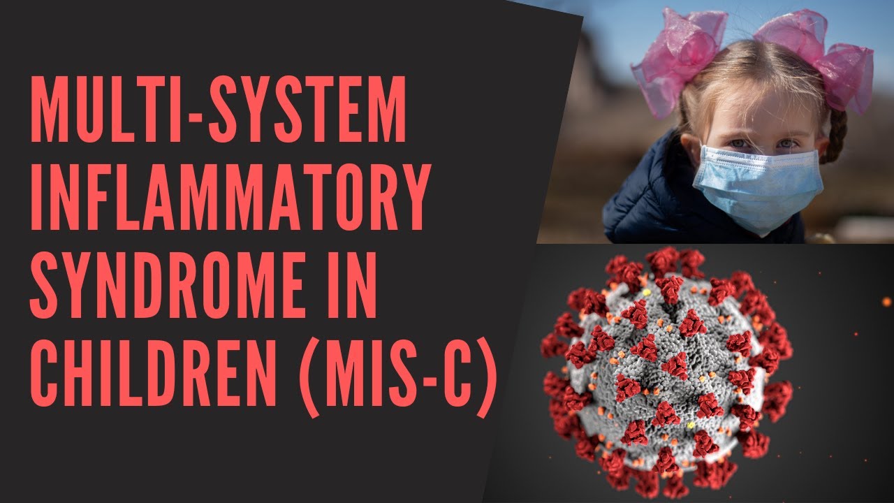 Multisystem Inflammatory Syndrome in Children (MIS-C) Review