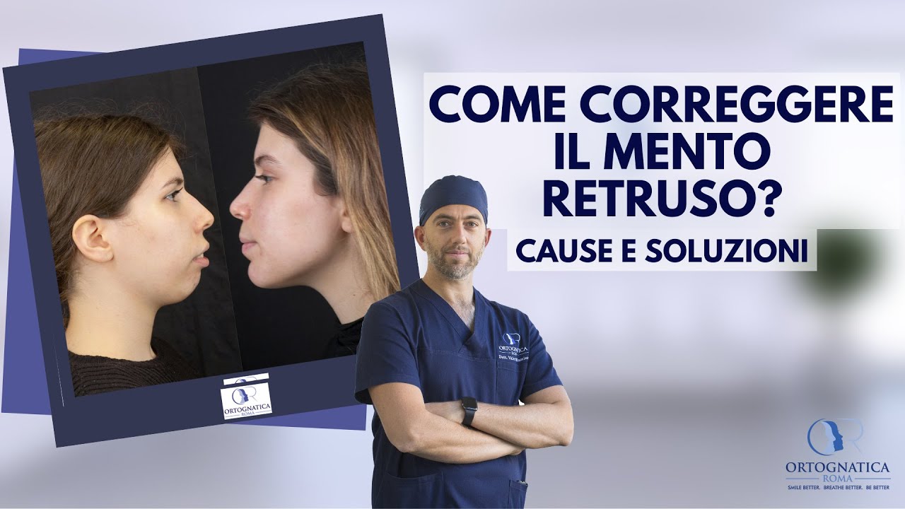 Come correggere il mento retruso?