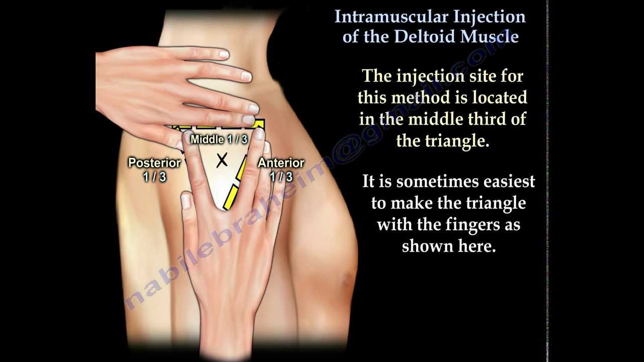 Deltoid Intramuscular injection - Everything You Need To Know - Dr. Nabil Ebraheim
