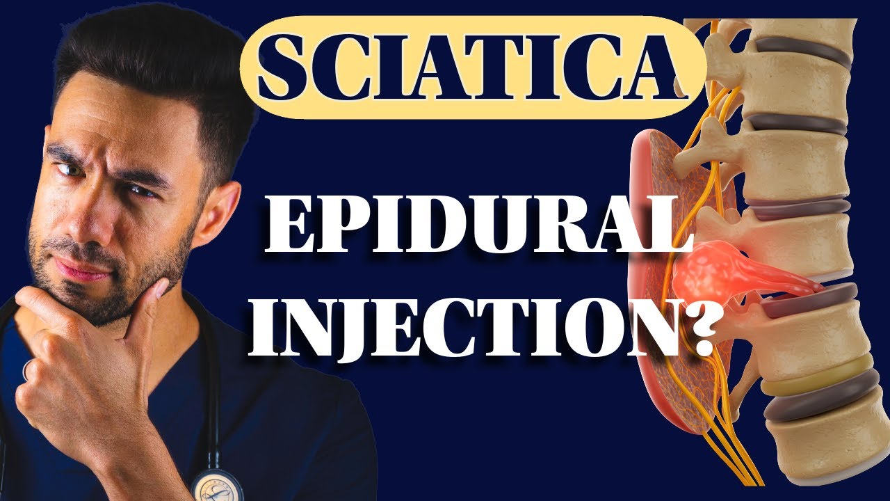 Lumbar Epidural Steroid Injections: 9 Things You NEED to Know!