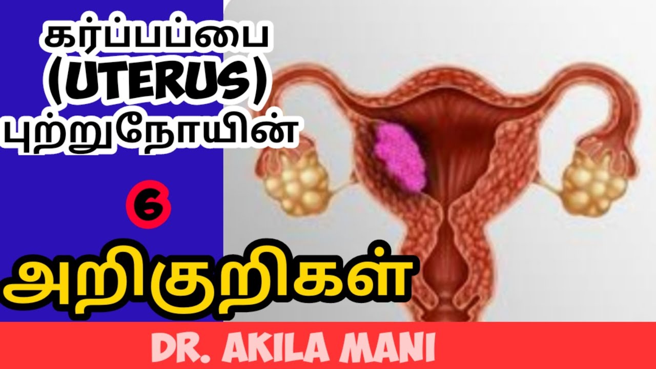 uterus cancer symptoms in tamil. uterine cancer in tamil. Dr. Akilamani. கர்ப்பப்பை புற்றுநோய்.