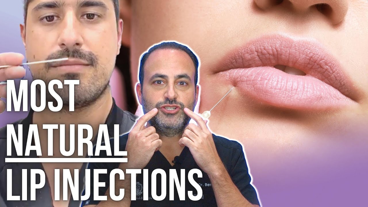 Achieving the Most Natural-Looking Lip Injections | Lesson of the Day