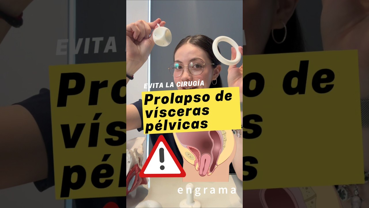 &iquest;Vejiga ca&iacute;da? Descubre c&oacute;mo los pesarios pueden ser tu mejor aliado