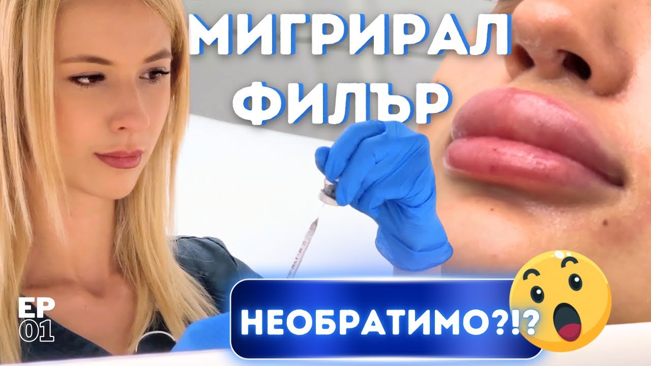 МИГРИРАЛ ФИЛЪР 🤯- Възможно ли е да възвърнем естествените си устни след това?ЗДРАВАВ и КРАСИВА КОЖА