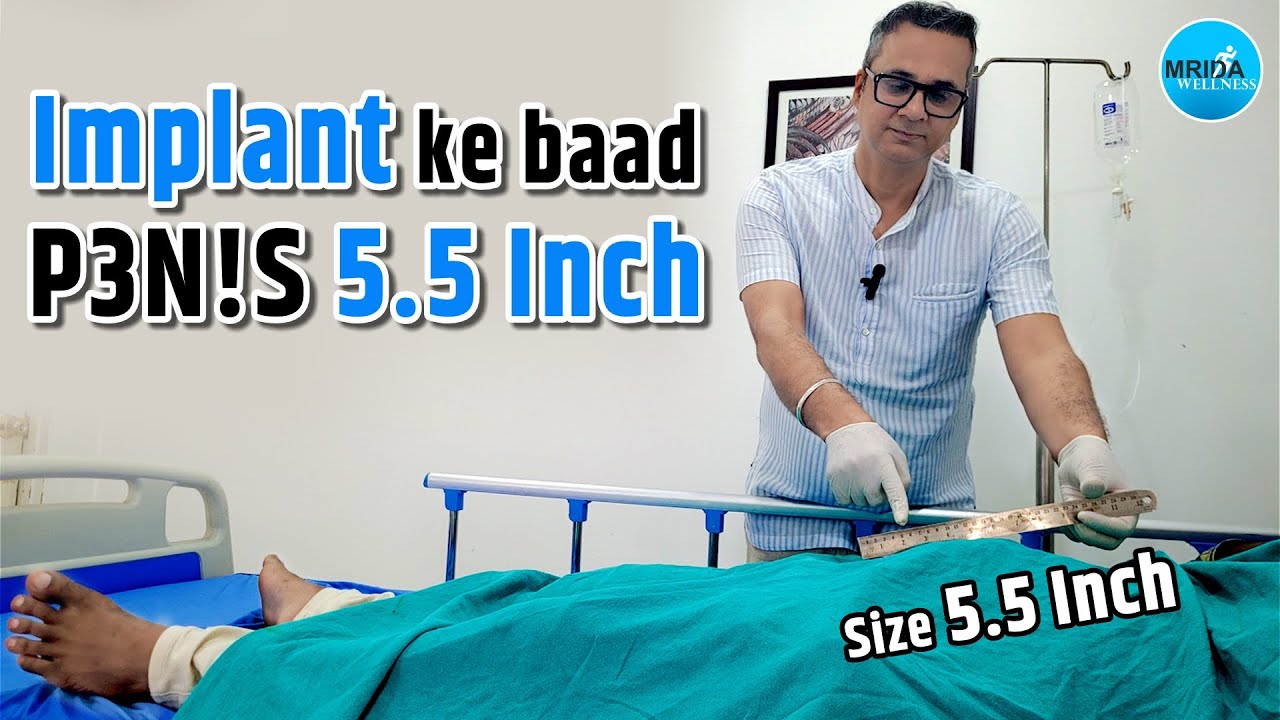 P3N!S Size After P3N!LE Implant Surgery: 5.5 Inch | Live Measurement | Real Patient Result: 5.5 Inch