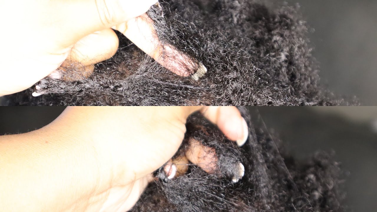 HOW TO: GENTLY Separate Matted Starter Locs | Two Strand Twist Starter Locs | NO PAIN