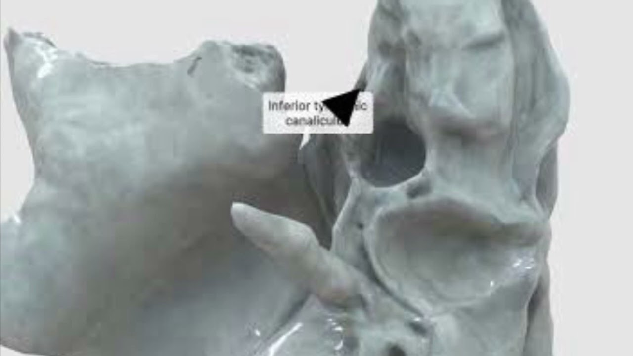 Lesser petrosal nerve forming canaliculus