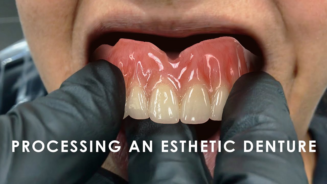 How to Process an Esthetic Denture
