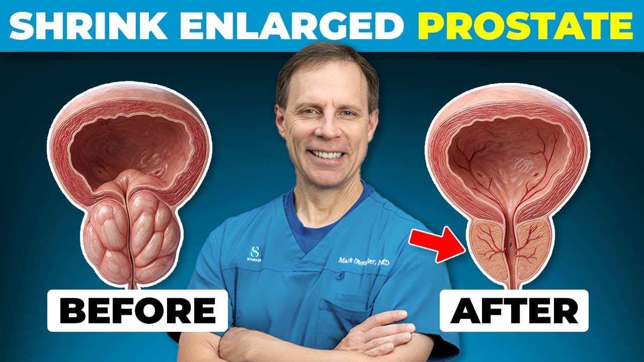 SENIORS | Top 4 Herbs to Shrink an Enlarged Prostate