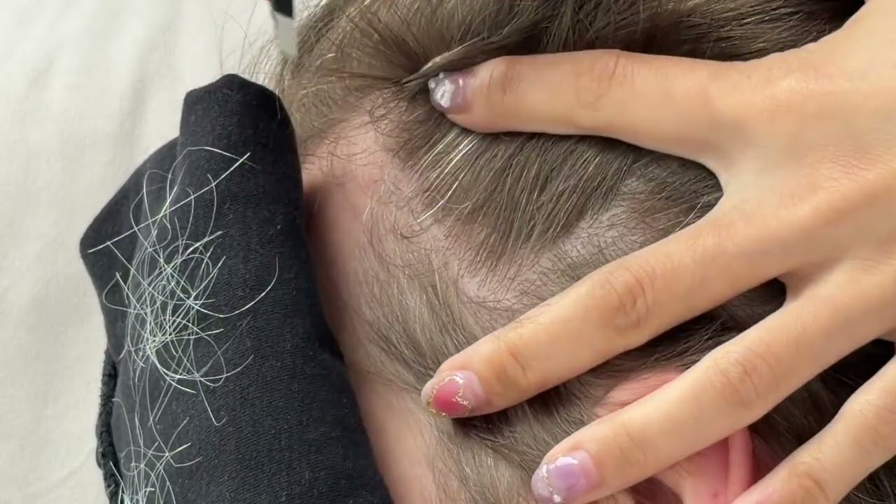 Relaxing gray hair plucking - Satisfying - ASMR 