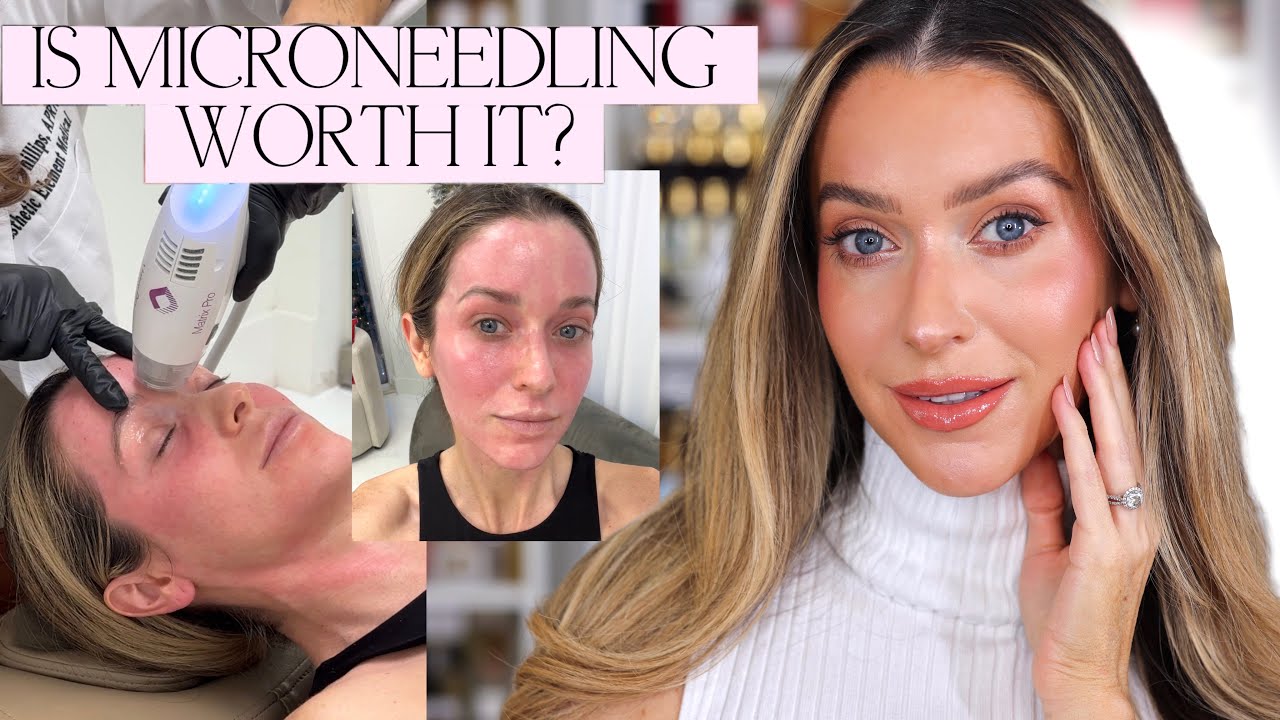 I TRIED A NEW ANTI-AGING SKINCARE TREATMENT!