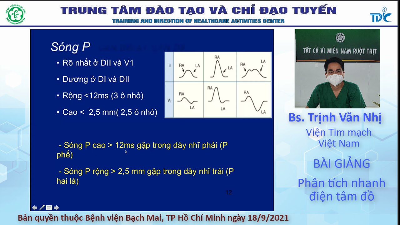 Các bước cơ bản phân tích nhanh điện tim đồ