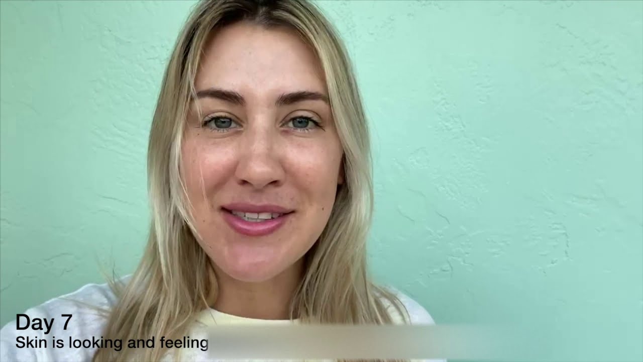 Halo Laser Treatment with 7 Days of Tracking Post Laser [4K] | OceanDrivePlasticSurgery.com