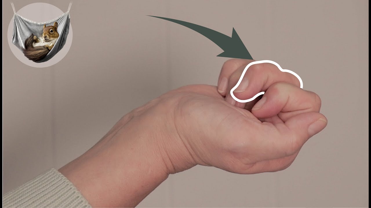 Was ist ein Schnappfinger? - kurze Erklärung