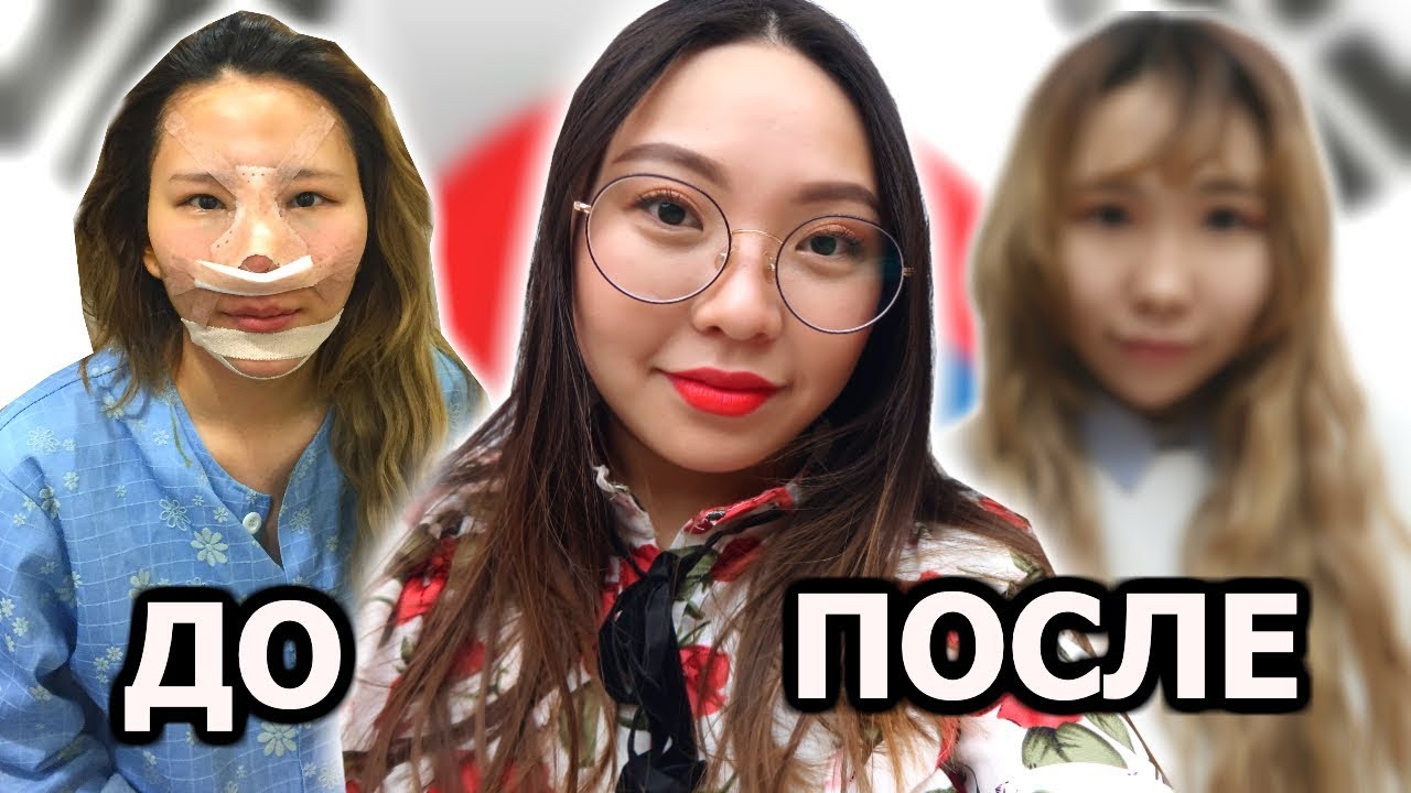 ПРЕОБРАЖЕНИЕ В КОРЕЕ! ДО И ПОСЛЕ ПЛАСТИЧЕСКИХ ОПЕРАЦИЙ!|NikyMacAleen