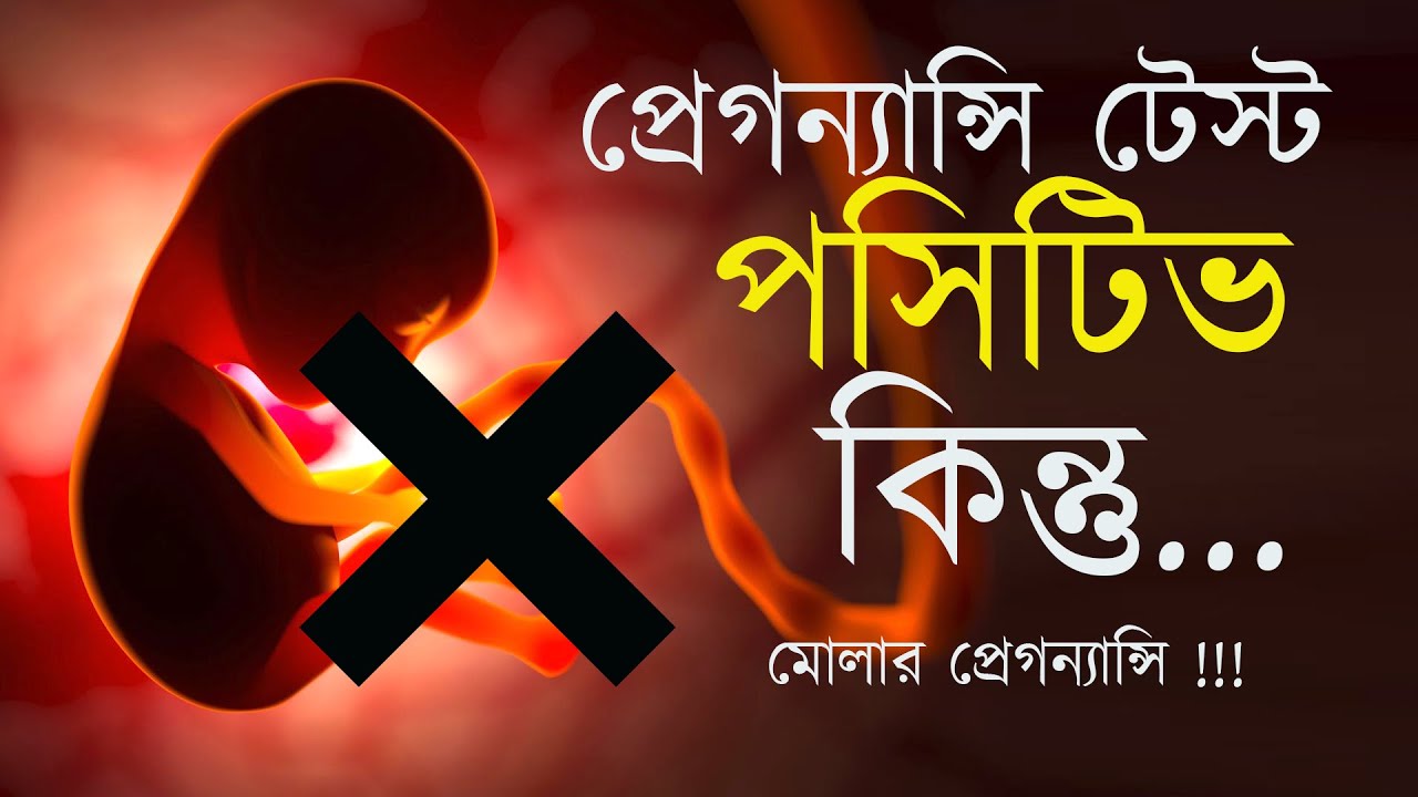 মোলার প্রেগন্যান্সি থেকে সাবধান | Molar Pregnancy | The Bong Parenting