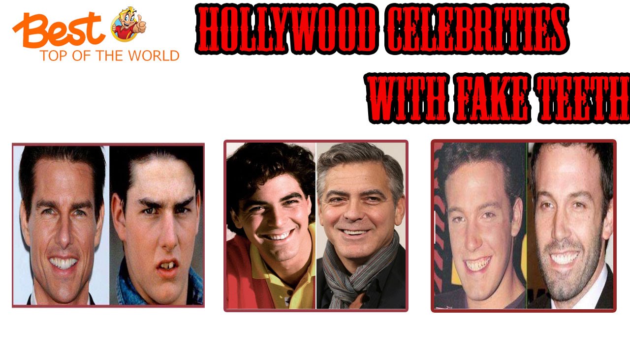 Best Top of The world Hollywood Celebrities with Fake Teeth